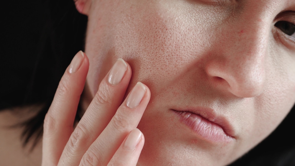 Comment enlever un microkyste du visage